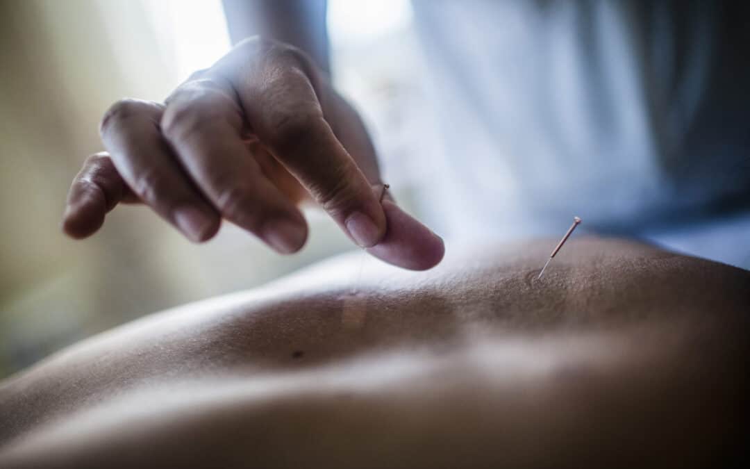Achieving a Healthier Life in Manhattan: The Benefits of Acupuncture